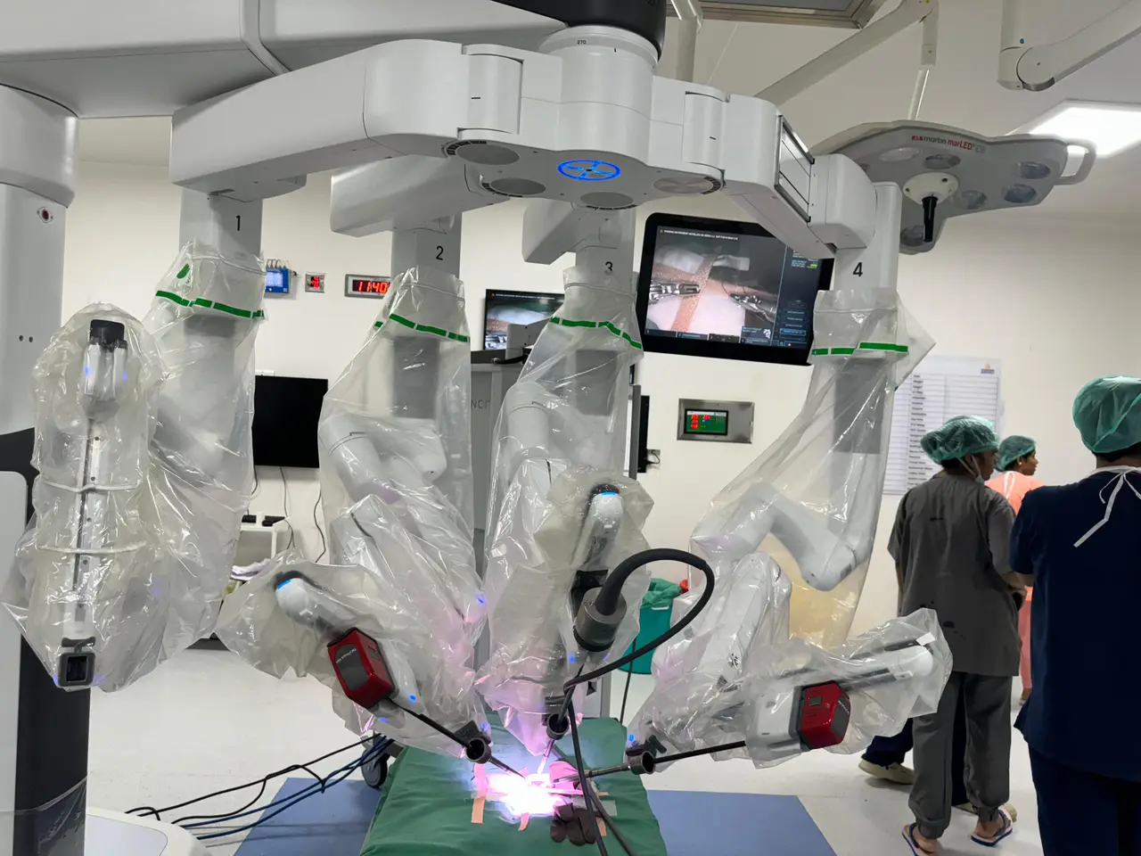 Robotics at Yashoda Hospital — Sudha Hospital, KPHB Hyderabad (photo 4)